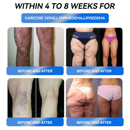 IFMAGIC® GLP-1 Pro Weight Loss Oral Solution 💧Canadian Obesity Physician Recommendations👩‍⚕️Suitable for obesity, cardiovascular diseases, diabetes, sleep apnea, high cholesterol and blood lipids, joint problems, and various other conditions✨